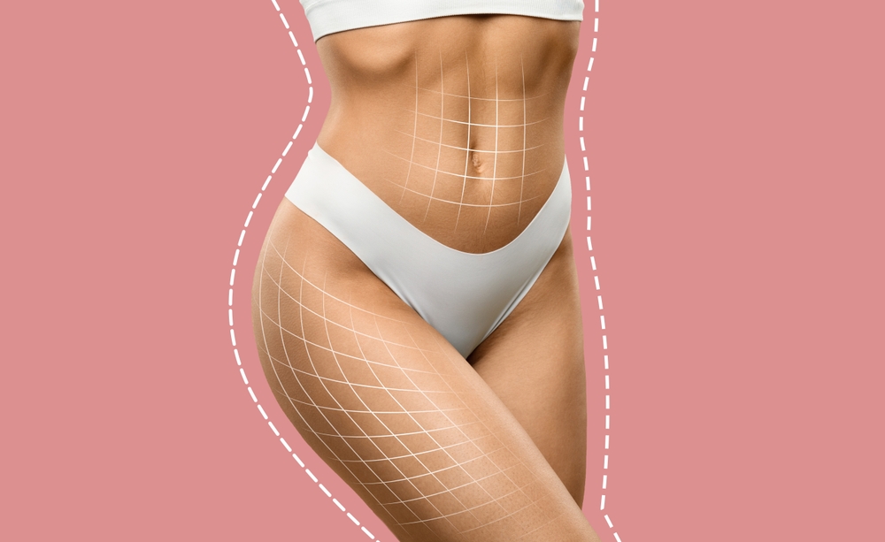 How Much Fat Does Laser Liposuction Take?